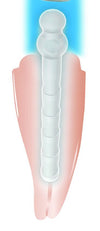 COLTENE ParaPost Fiber Lux