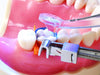 Garrison Dental Solutions PerForm Kontaktformer