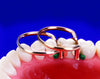 Garrison Dental Solutions Composi-Tight Gold